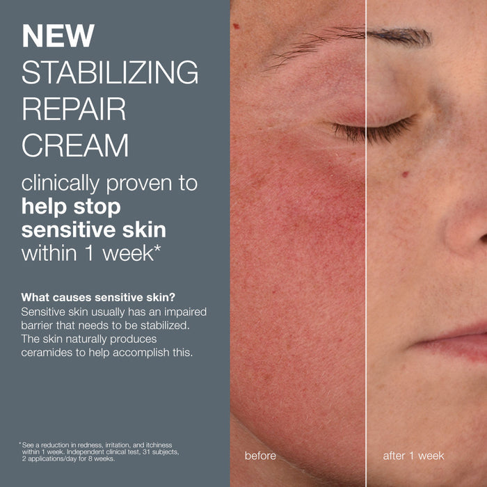 Before and after results of using Dermalogica Stabilizing Repair Cream