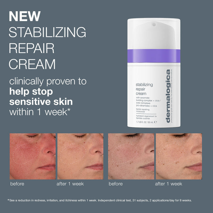 Before and after results of using Dermalogica Stabilizing Repair Cream