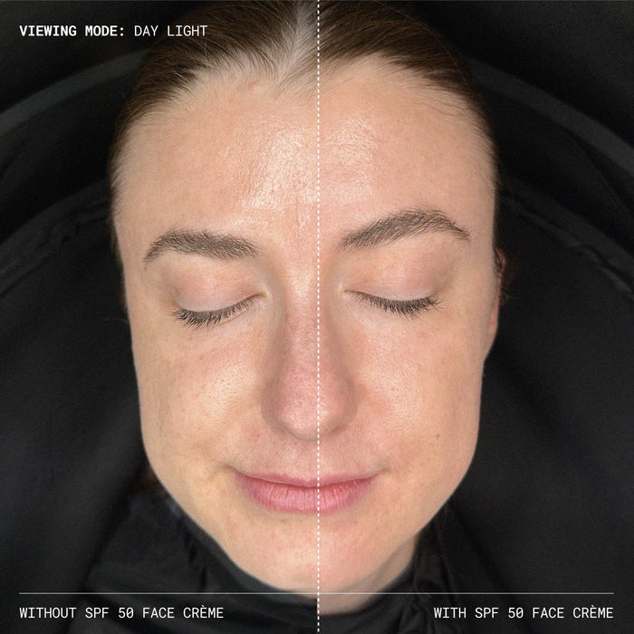 Before and after results of using Emma Lewisham Sunceutical Mineral Face Cream SPF 50