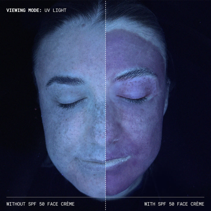 Before and after results of using Emma Lewisham Sunceutical Mineral Face Cream SPF 50