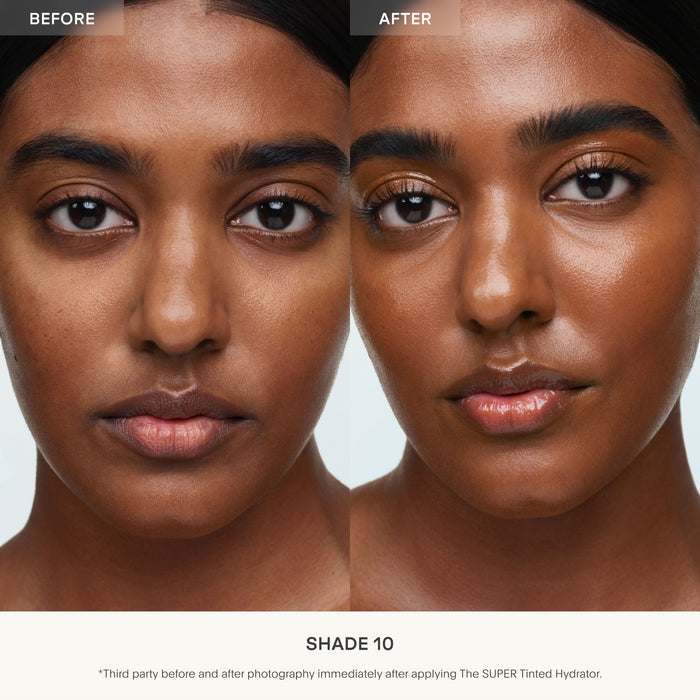 Before and after results of using U Beauty Super Tinted Hydrator variant: 10