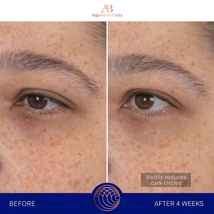 Before and after results of using Augustinus Bader The Eye Patches variant: 1 Treatment