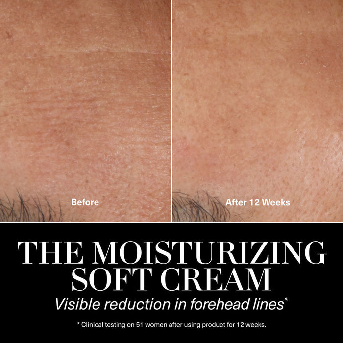 Before and after results of using La Mer The Moisturizing Soft Cream variant: 2 oz