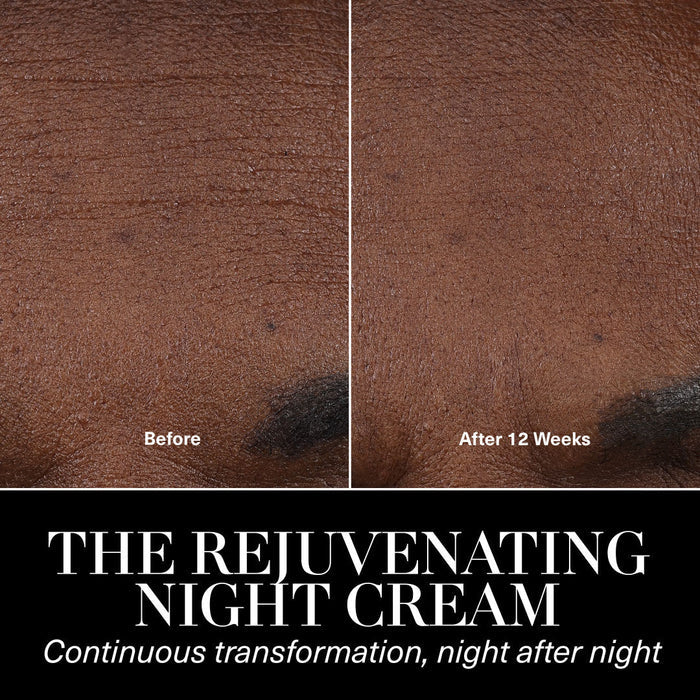 Before and after results of using La Mer The Rejuvenating Night Cream variant: 1 fl oz