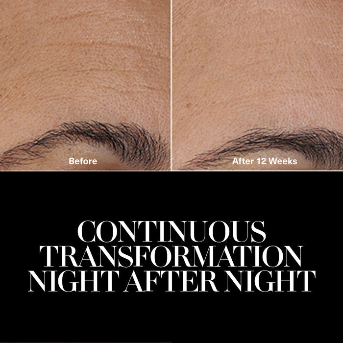 Before and after results of using La Mer The Rejuvenating Night Cream variant: 1 fl oz