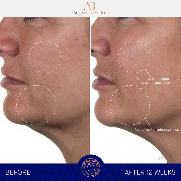 Before and after results of using Augustinus Bader The Rich Cream variant: 1 fl oz