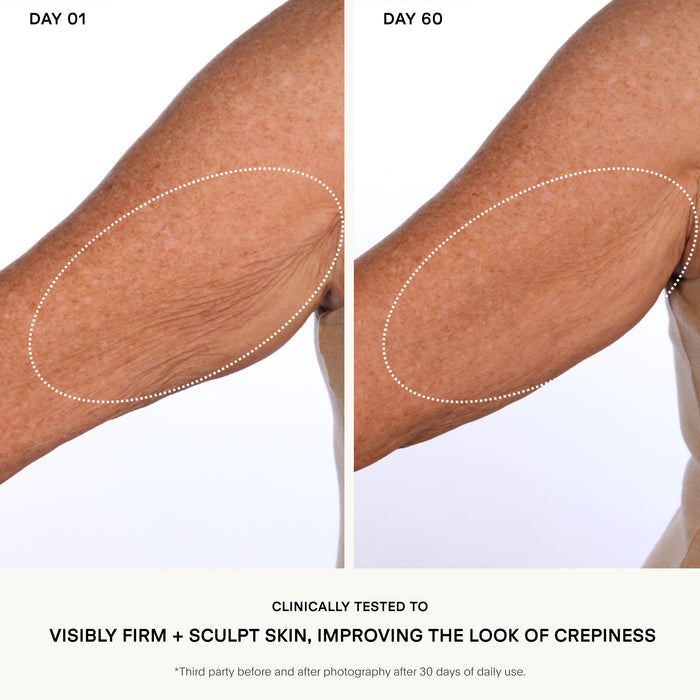 Before and after results of using U Beauty The Sculpt Arm Compound
