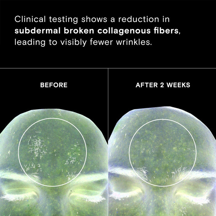 Before and after results of using Exponent Time Rewind Retinol Power Serum