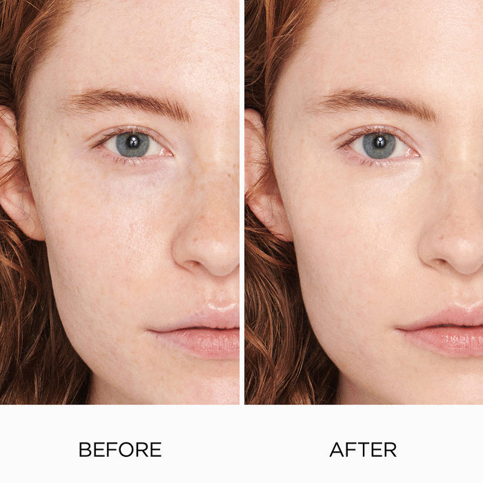 Before and after results of using   variant: 0N1 PETAL