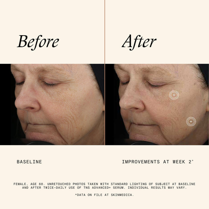 Information related to SkinMedica TNS Advanced+ Serum
