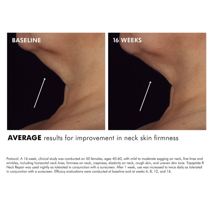 Before and after results of using SkinCeuticals Tripeptide-R Neck Repair