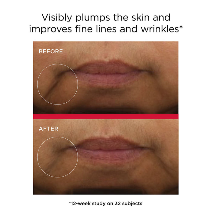 Before and after results of using EltaMD UV Daily Hydration+ Broad Spectrum SPF 50