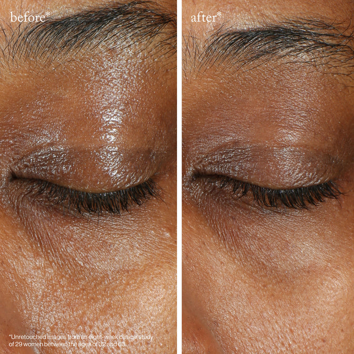 Before and after results of using Goop Beauty Vita-C Brightening Eye Cream