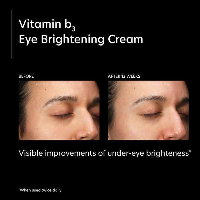 Before and after results of using PCA Skin Vitamin B3 Eye Brightening Cream