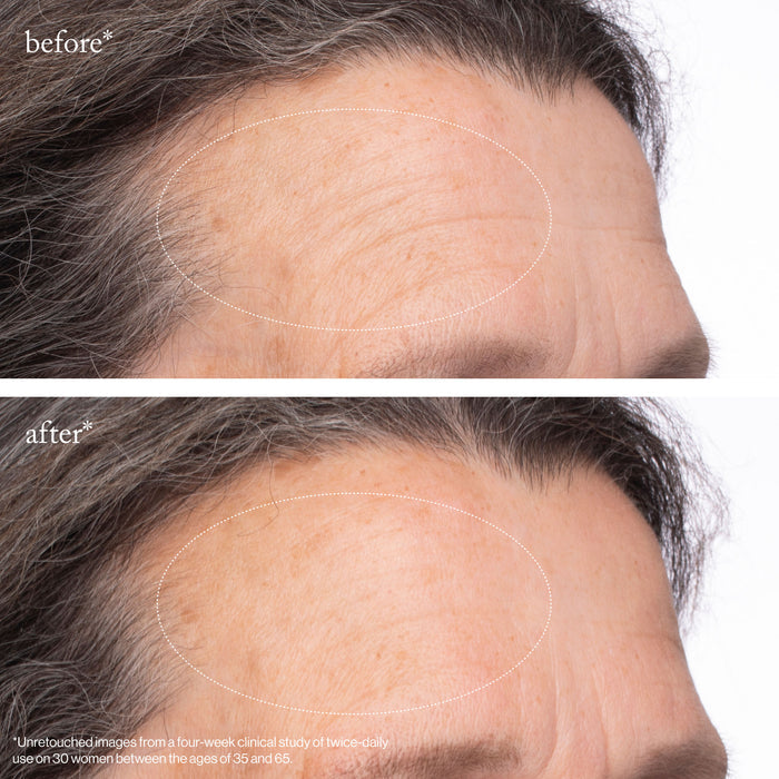 Before and after results of using Goop Beauty Youth-Boost NAD+ Peptide Rich Cream