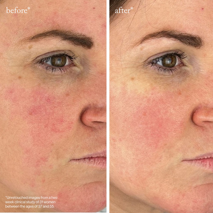 Before and after results of using Goop Beauty Youth-Boost Peptide Serum